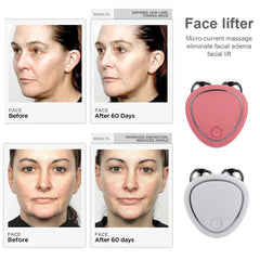EMS Beauty Roller | Facial Toning | Skin Tightening Tool